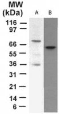 Western Blot: p73 Antibody (5B429)BSA Free [NBP2-24737]