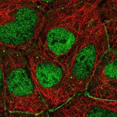 Immunocytochemistry/ Immunofluorescence: p73 Antibody [NBP2-58335]