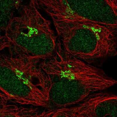 Immunocytochemistry/ Immunofluorescence: p73 Antibody [NBP2-58523]
