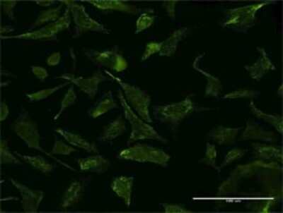 Immunocytochemistry/ Immunofluorescence: p97/VCP Antibody (2B2) [H00007415-M18]