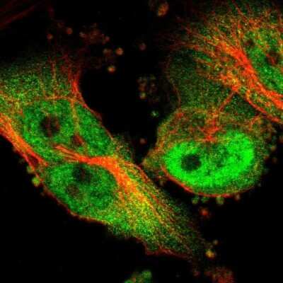 Immunocytochemistry/ Immunofluorescence: p97/VCP Antibody [NBP1-81619]