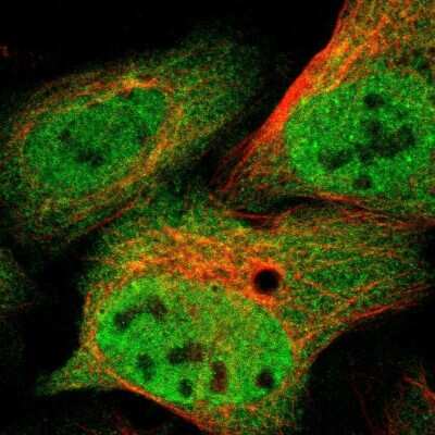 Immunocytochemistry/ Immunofluorescence: p97/VCP Antibody [NBP1-81620]