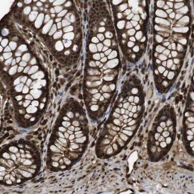 Immunohistochemistry-Paraffin: p97/VCP Antibody [NBP1-81619]
