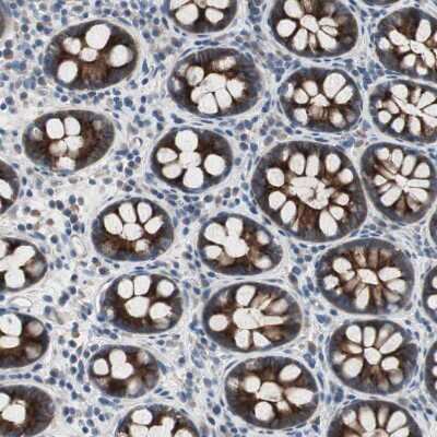 Immunohistochemistry-Paraffin: pIgR Antibody [NBP1-86504]