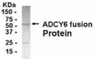 Western Blot: Adenylate Cyclase 6 Antibody [NB100-75180]