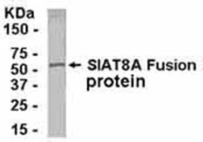 Western Blot: ST8 alpha-2,8-Sialyltransferase 8A/ST8SIA1/Ganglioside GD3 Antibody [NB100-75632]