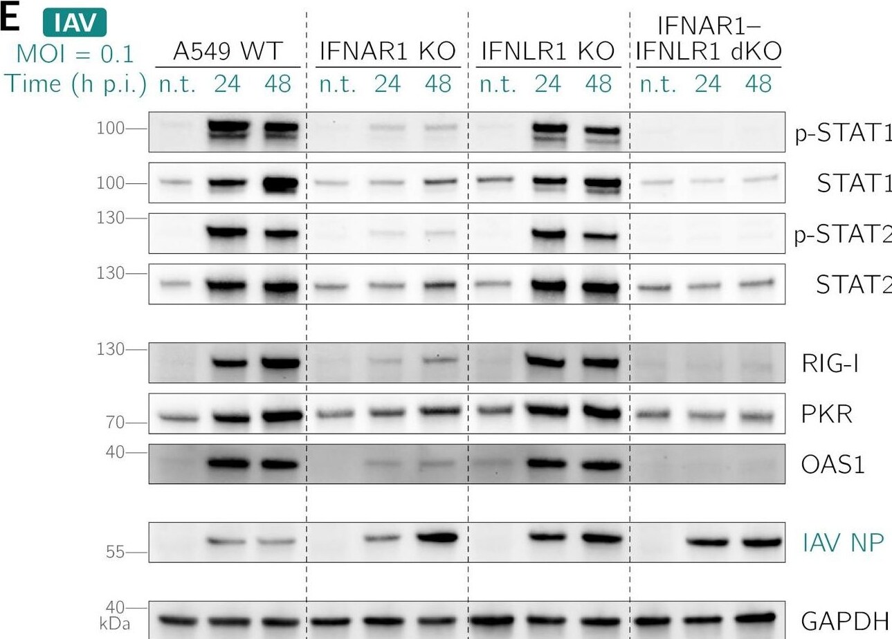 Detection of STAT2 by Western Blot