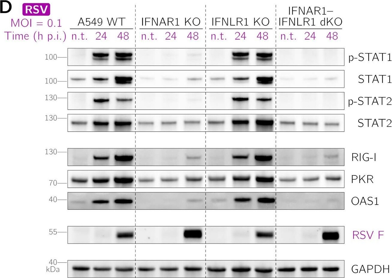 Detection of STAT2 by Western Blot