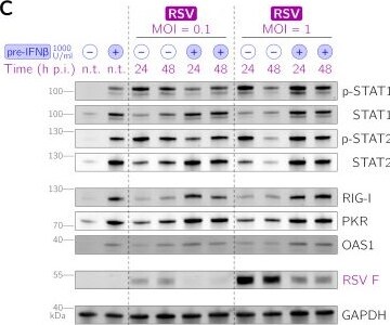 Detection of STAT2 by Western Blot