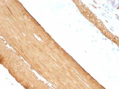 Immunohistochemistry-Paraffin: Actin (Muscle Specific) Antibody (HHF35 + MSA/953) - Azide and BSA Free [NBP2-47663]