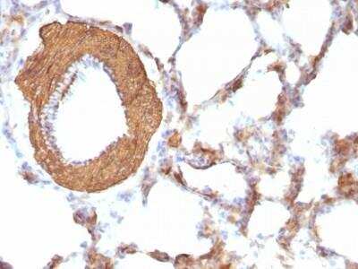 Immunohistochemistry-Paraffin: Actin (Muscle Specific) Antibody (HHF35 + MSA/953) - Azide and BSA Free [NBP2-47663]