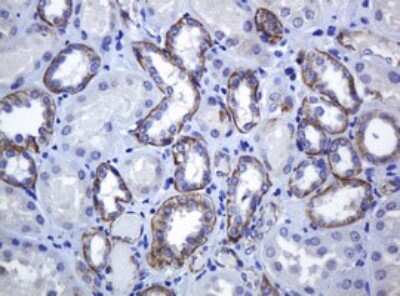 Immunohistochemistry: pan Cadherin Antibody (OTI4F1) [NBP2-46200]