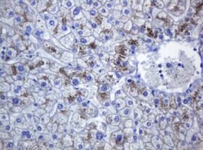 Immunohistochemistry: pan Cadherin Antibody (OTI4F1) [NBP2-46200]