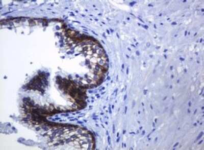 Immunohistochemistry: pan Cadherin Antibody (OTI4F1) [NBP2-46200]