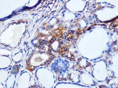 Immunohistochemistry-Paraffin: pan Cadherin Antibody (6N5P8) [NBP3-16509]