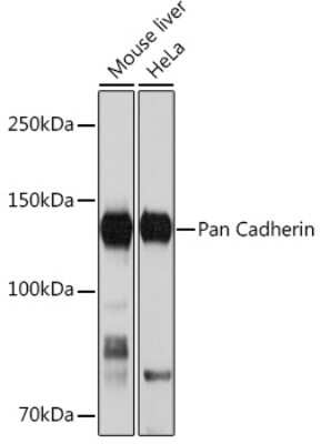 Western Blot: pan Cadherin Antibody (6N5P8) [NBP3-16509]