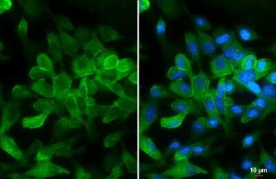 Immunocytochemistry/ Immunofluorescence: pan Cadherin Antibody [NBP3-13122]
