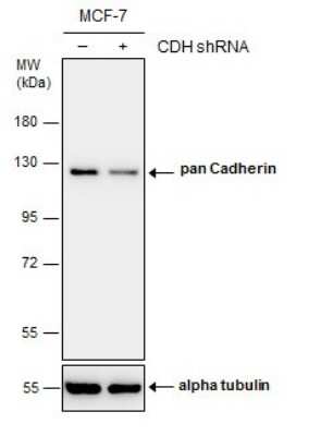 Western Blot: pan Cadherin Antibody [NBP3-13122]