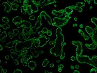 Immunohistochemistry-Paraffin: Cytokeratin, pan Antibody (PCK-26) [NB120-6401]