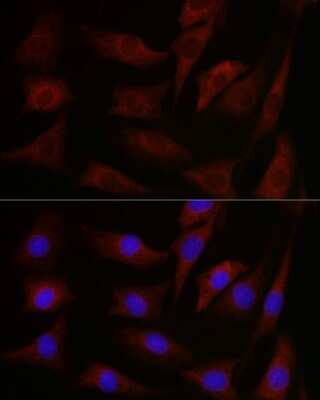 Immunocytochemistry/ Immunofluorescence: pan PKC Antibody - BSA Free [NBP3-05673]