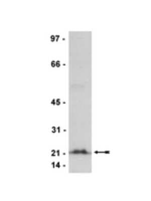 Western Blot: pan RhO/RAC/CDC42 Antibody (3L74) [NBP2-29740]