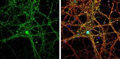 Immunocytochemistry/ Immunofluorescence: pan-Synuclein Antibody [NBP3-13218]