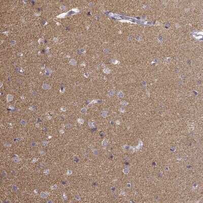 Immunohistochemistry-Paraffin: pan-Synuclein Antibody [NBP2-47338]
