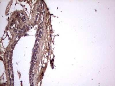 Immunohistochemistry: phakinin Antibody (OTI4E7) [NBP2-46573]
