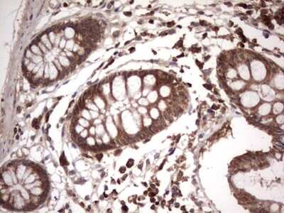 Immunohistochemistry: phakinin Antibody (OTI4E7) [NBP2-46573]