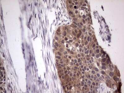 Immunohistochemistry: phakinin Antibody (OTI4E7) [NBP2-46573]