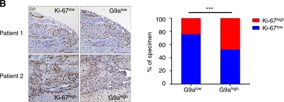 Detection of Human G9a/EHMT2 by Immunohistochemistry