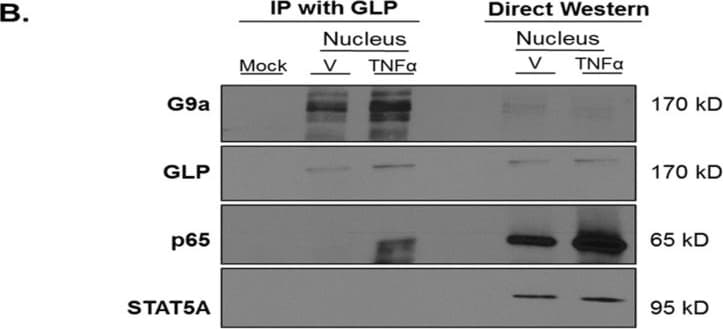 Detection of GLP/EHMT1 by Western Blot