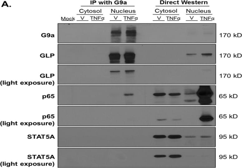 Detection of GLP/EHMT1 by Western Blot
