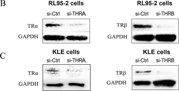 Detection of TR alpha /NR1A1 by Western Blot