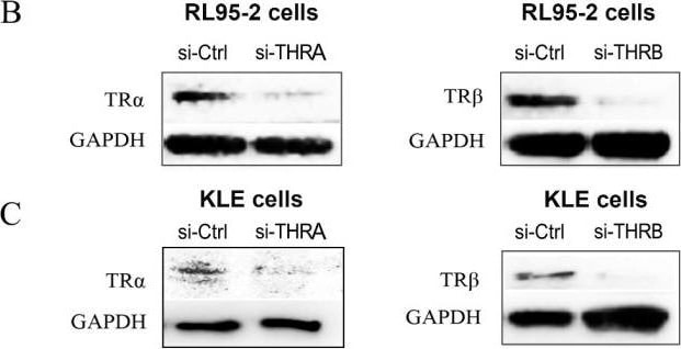 Detection of TR alpha /NR1A1 by Western Blot