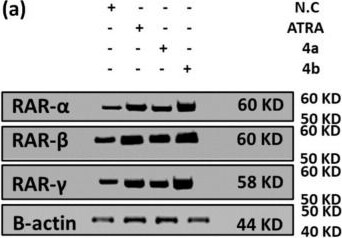 Detection of RAR beta/NR1B2 by Western Blot