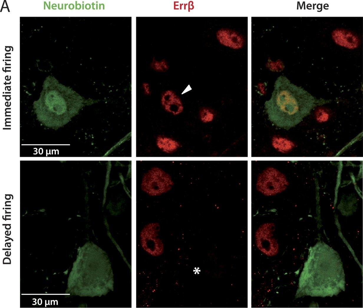 Detection of Mouse ERR beta/NR3B2 by Immunocytochemistry/Immunofluorescence