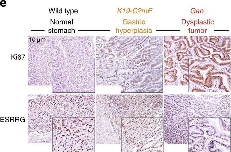 Detection of ERR gamma/NR3B3 by Immunohistochemistry