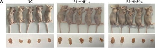 Detection of HNF-4 alpha/NR2A1 by Immunohistochemistry