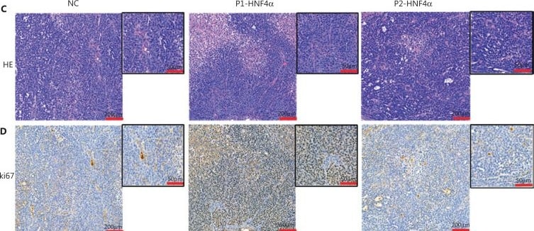 Detection of HNF-4 alpha/NR2A1 by Immunohistochemistry