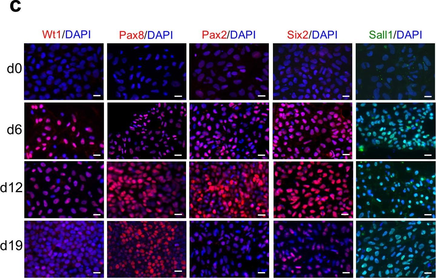 Detection of Human SALL1 by Immunocytochemistry/ Immunofluorescence