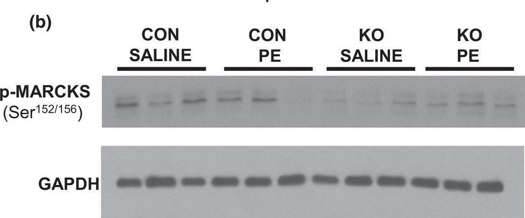 Detection of Phospho-MARCKS (S152/S156) by Western Blot