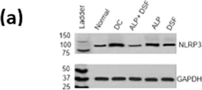 Detection of GABA-A R gamma 2 by Western Blot