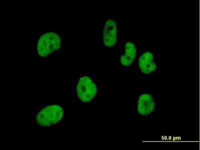 Immunocytochemistry/ Immunofluorescence: pre-mRNA cleavage factor I (59 kDa subunit) Antibody [H00079869-B01P]