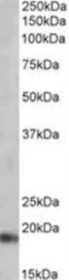 Western Blot: Atrial Natriuretic Peptide/ANP Antibody [NBP1-97752]