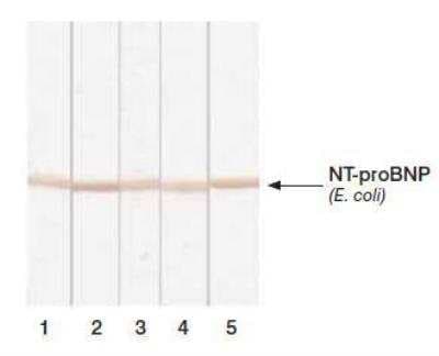 Western Blot: NT-proBNP Antibody (5B6cc) [NB120-13111]