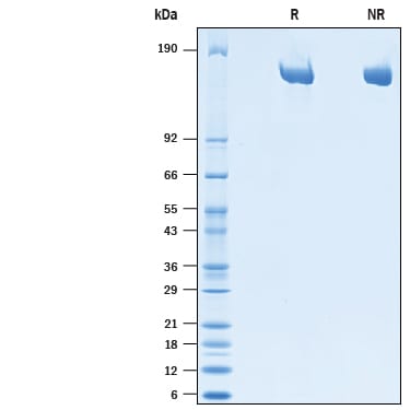 Recombinant Human Mrc2 His-tag Protein SDS-PAGE