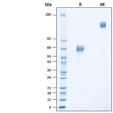 Recombinant Porcine PD-1 Fc Chimera Protein SDS-PAGE