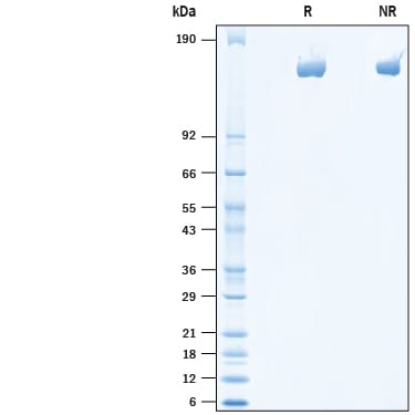 Recombinant Mouse Mrc2 His-tag Protein SDS-PAGE