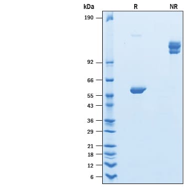 Recombinant Human Ly-6G6F Fc Chimera Protein SDS-PAGE